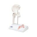 模型Human Model ミニ関節モデル 股関節 A84/1 3B Scientific