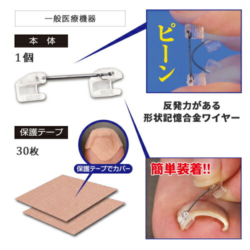 ■ポスト投函■巻き爪ワイヤーガード