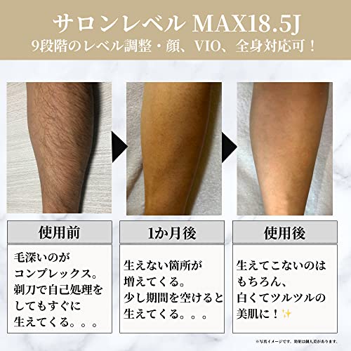 除毛器 Remozer 2 Pro Self メンズ 髭 除毛機 VIO対応 光美容器 プロ級ハイパワー ...