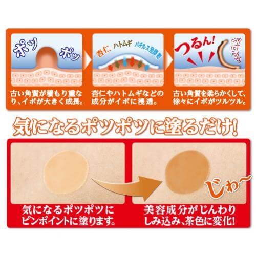 【マラソン限定！ポイント6倍！】イポロン P 20g 2個セット ハトムギ クリーム 角質 送料無料