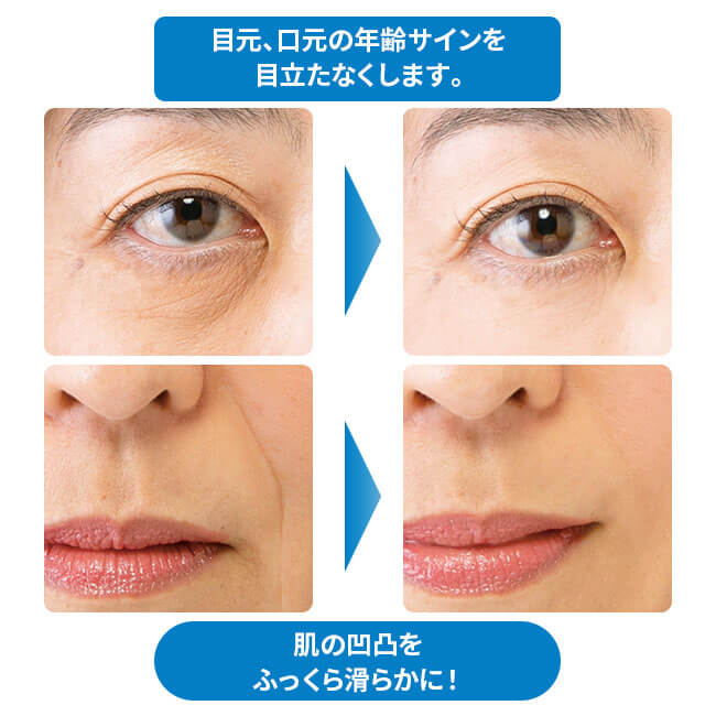 【3/10(火)限定！楽天カードでポイント最大12倍！】ウィンクル イージーサポートジェルEX 25g 3個セット アイクリーム 保湿 目元 送料無料