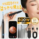 【★3,380→1,960★楽天1位】 耳かき カメラ 800万画素 耳かき 子供 耳かき ピンセット ライト イヤースコープ 耳掻き 耳掃除 耳そうじ ピンセット カメラ付き 子供 ライト みみかき 照明付き 介護 大人 赤ちゃん LED こども 子供用 綿棒 iphone Android