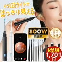 【10%OFF★楽天1位】 耳かき カメラ 耳かき 子供 耳かき ピンセット ライト 800万画素 イヤースコープ 耳掻き 耳掃除 耳そうじ ピンセット カメラ付き 子供 ライト みみかき 照明付き 介護 大人 赤ちゃん LED こども 子供用 綿棒 iphone Android
