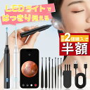 【★クーポンで2,080★楽天1位】 耳かき カメラ 800万画素 耳かき 子供 耳かき ピンセット ライト イヤースコープ 耳掻き 耳掃除 耳そうじ ピンセット カメラ付き 子供 ライト みみかき 照明付き 介護 大人 赤ちゃん LED こども 子供用 綿棒 iphone Android
