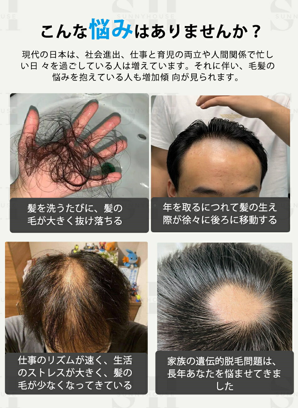 【業界初×USB充電式】育毛キャップ 赤色LED 育毛システム85個led 5種類光治療モード＆3種類光輝度調整育毛 赤色光育毛ヘルメット スカルプケア LEDライト 育毛ケア 薄毛・抜け毛対策 発毛促進 植毛補強 増毛 脱毛 頭皮ケア育毛キャップ 育毛ヘルメット治療ライト男女兼用