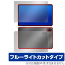 ミヤビックス OverLay Eye Protector for HEADWOLF HPad 6 表面・背面(Brilliant)セット OEHDWLFHPAD6/S/1